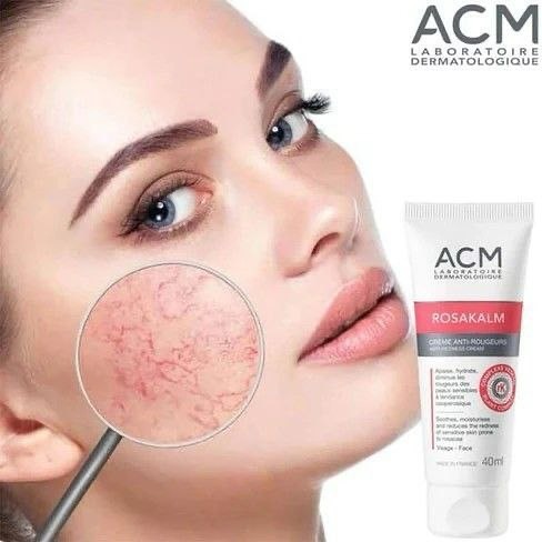 کرم ضد قرمزی و التیام بخش و تسکین دهنده ACM مدل ROSAKALM حجم ۴۰ میل