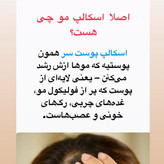 سرم اسکالپی سیپوری تقویت کننده و ضد ریزش مو